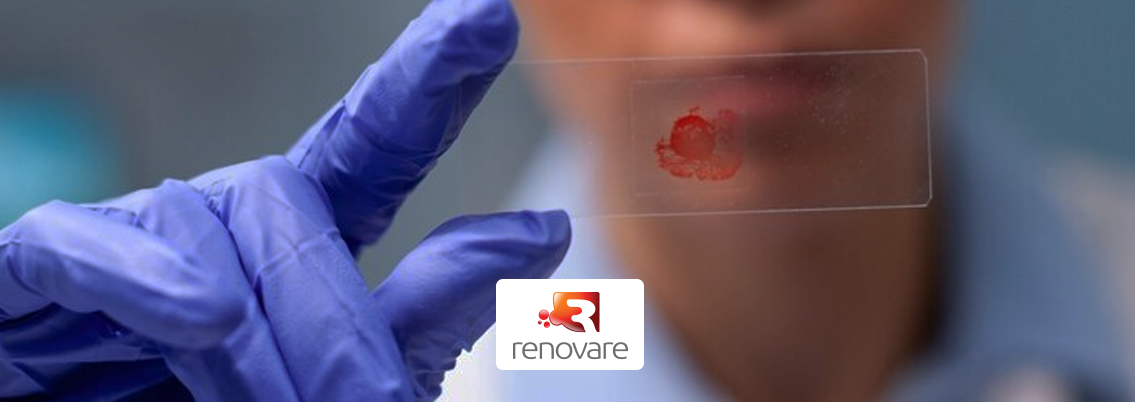Teste de DNA