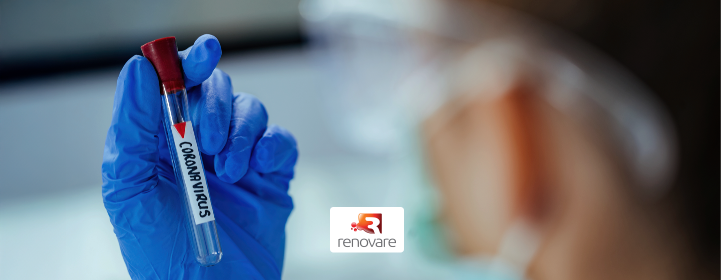 Teste RT-PCR